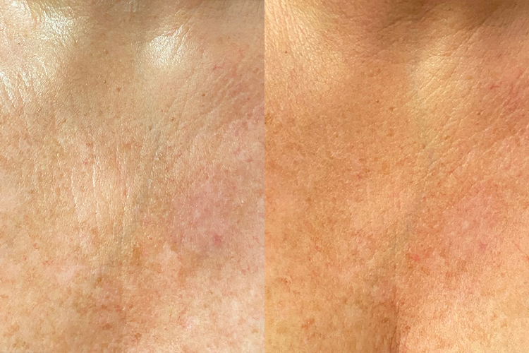 Opus-Before-After-Web-Desai-1tx
