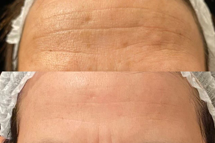 Opus-Before-After-Web-Desai-2txs